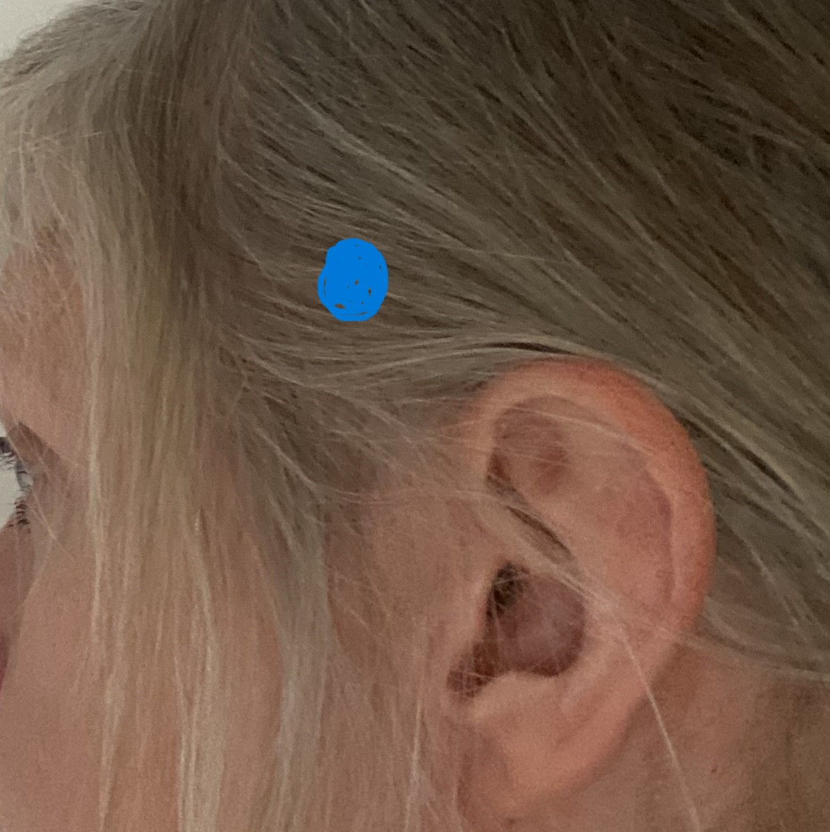 location of amygdala location of amygdala